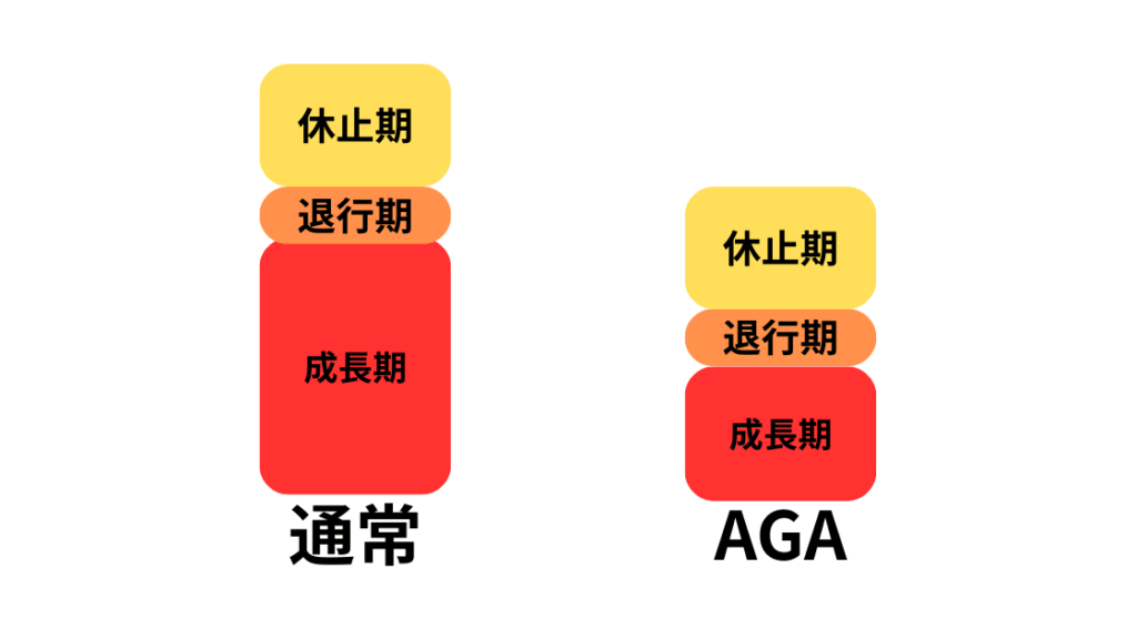 AGA（男性型脱毛症）