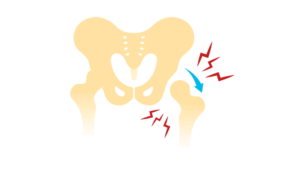 産後に股関節痛が起こる原因とは？