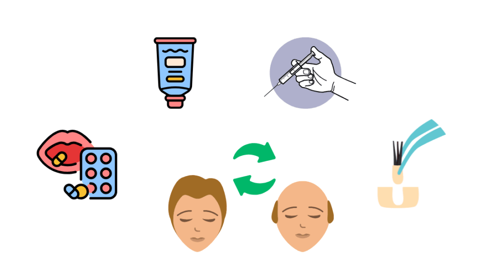 AGA治療の主な種類と特徴